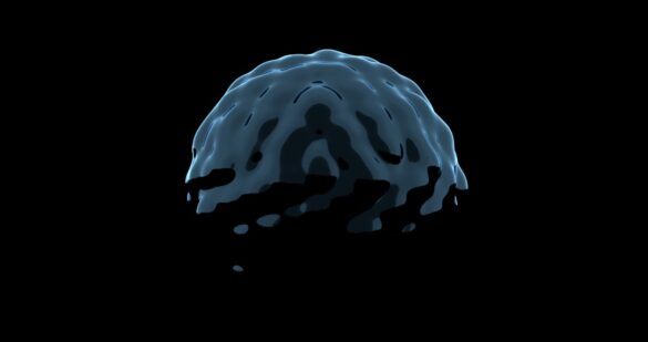 Photo Brain scan